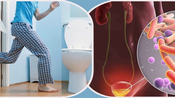 urine 20230611164610 - Bd Sylhet News