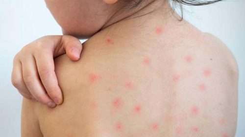 Ham 20260414173130 - Bd Sylhet News