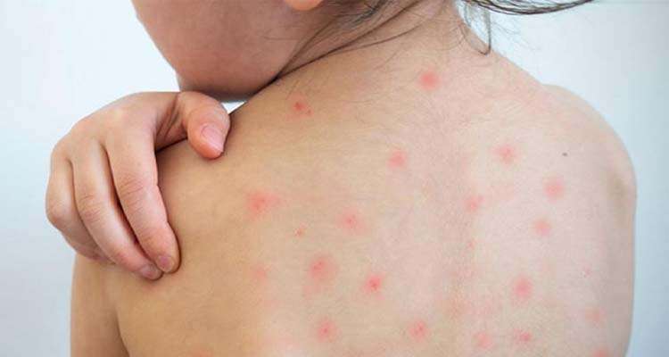 Ham 20260414173130 - Bd Sylhet News