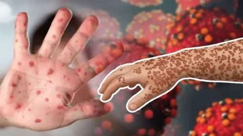 Ham 22 20260407172844 - Bd Sylhet News