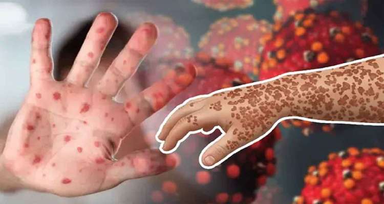 Ham 22 20260407172844 - Bd Sylhet News