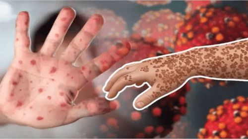 ham 1 - Bd Sylhet News