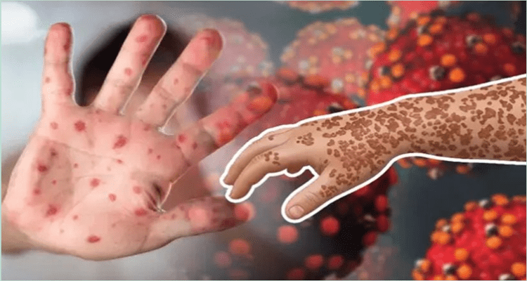 ham 1 - Bd Sylhet News